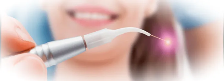 Лазер в стоматологии: безопасность и эстетика