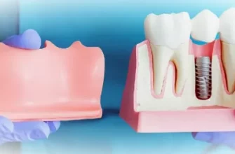 Осложнения после протезирования зубов