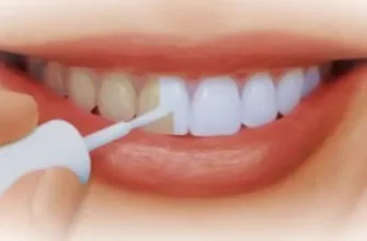 Можно ли отбеливать зубы в домашних условиях