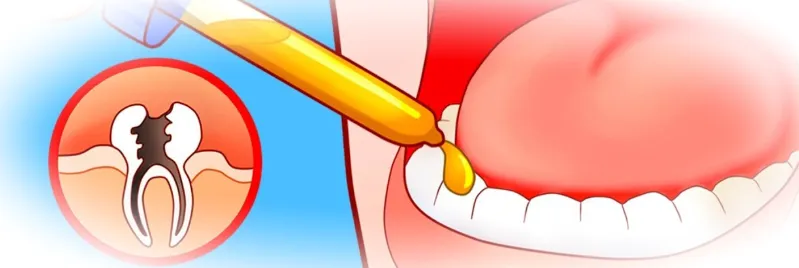 Почему нельзя лечить зубы дома
