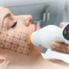 Подтяжка лица при помощи аппарата Thermage