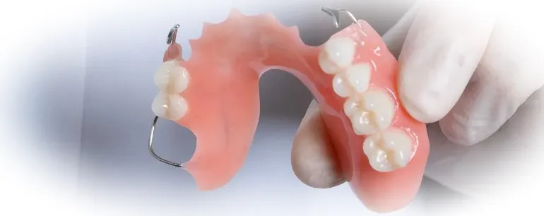 Частично-съемные протезы: преимущества и установка